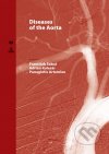Diseases of the aorta