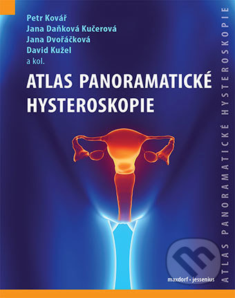 Atlas panoramatické hysteroskopie