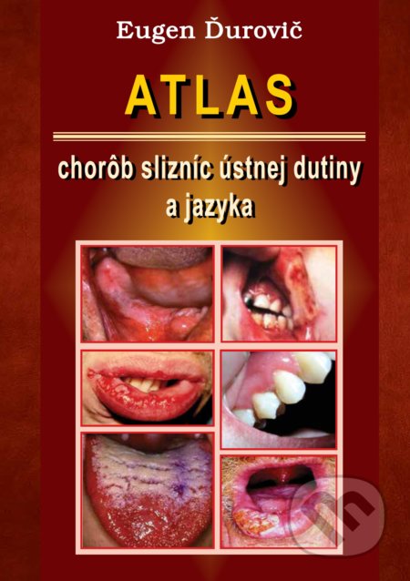 Atlas chorôb slizníc ústnej dutiny a jazyka