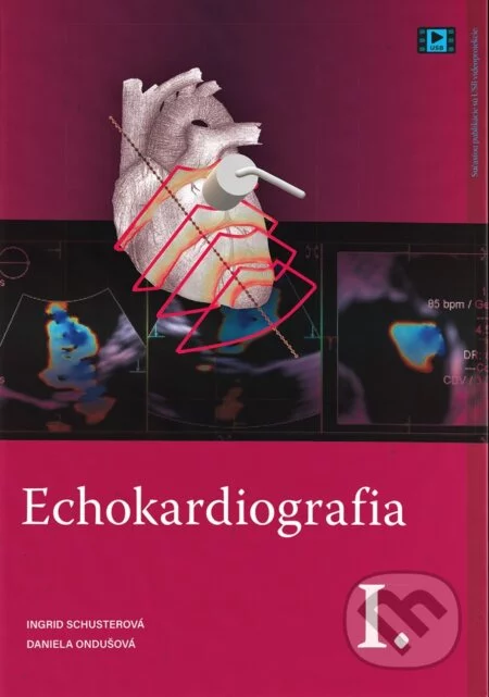 Echokardiografia