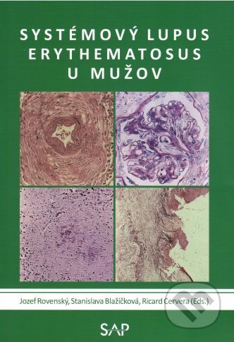 Systémový lupus erythematosus u mužov