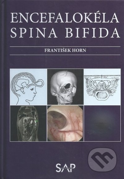 Encefalokéla Spina bifida