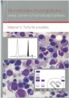 Monoklonální imunoglobuliny - výskyt, význam a možnosti jejich průkazu