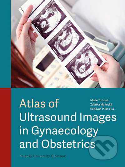 Atlas of ultrasound images in gynaecology and obstetrics