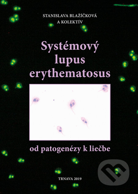 Systémový lupus erythematosus - od patogenézy k liečbe