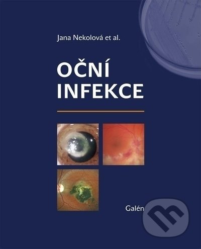 Oční infekce