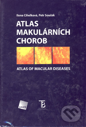 Atlas makulárních chorob