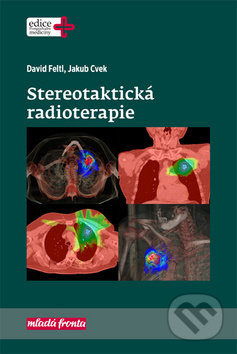 Stereotaktická radioterapie