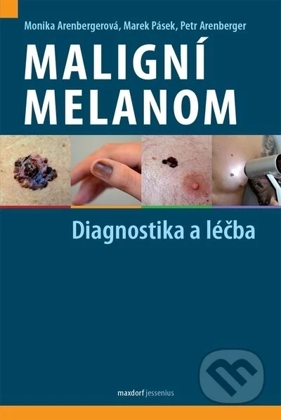 Maligní melanom