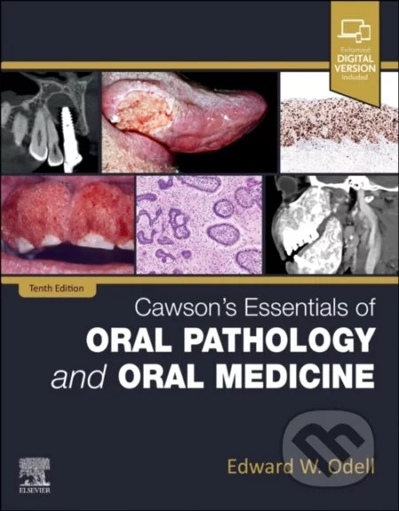 Cawson's essentials of oral pathology and oral medicine